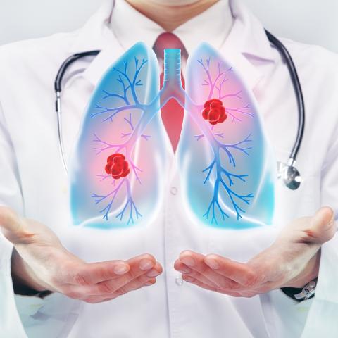 Pulmonary Disorders Images of unhealthy lungs